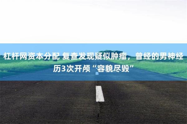 杠杆网资本分配 复查发现疑似肿瘤，曾经的男神经历3次开颅“容貌尽毁”